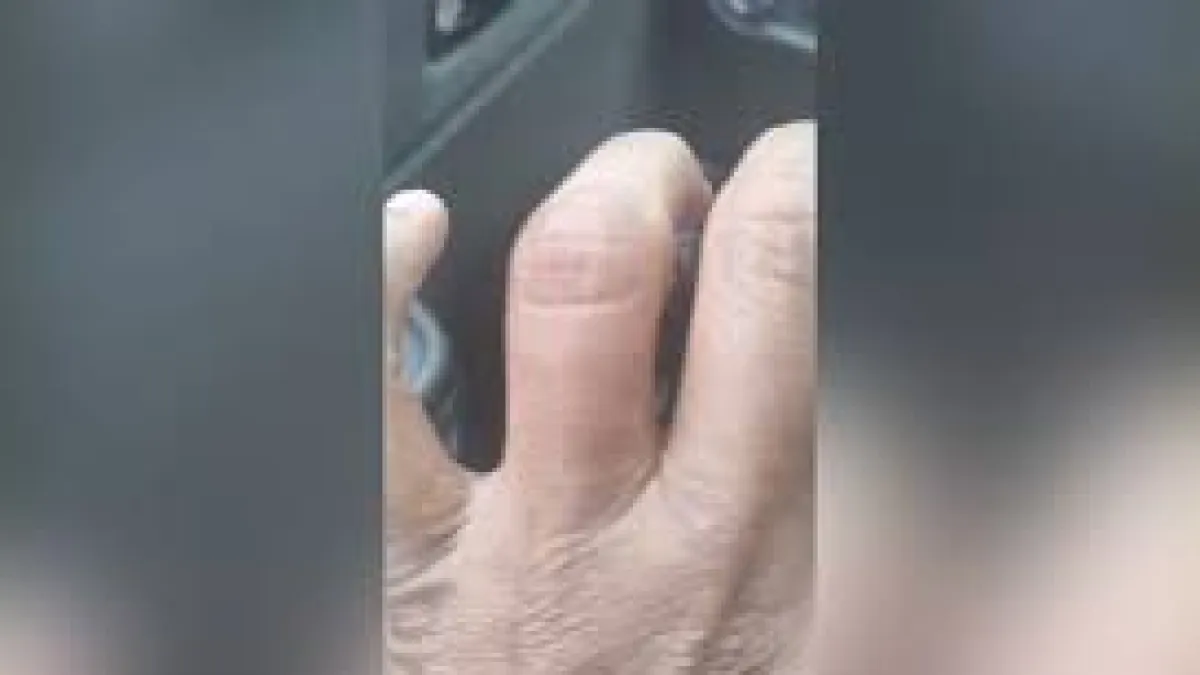 Ladrão morde motorista de táxi para roubar aliança